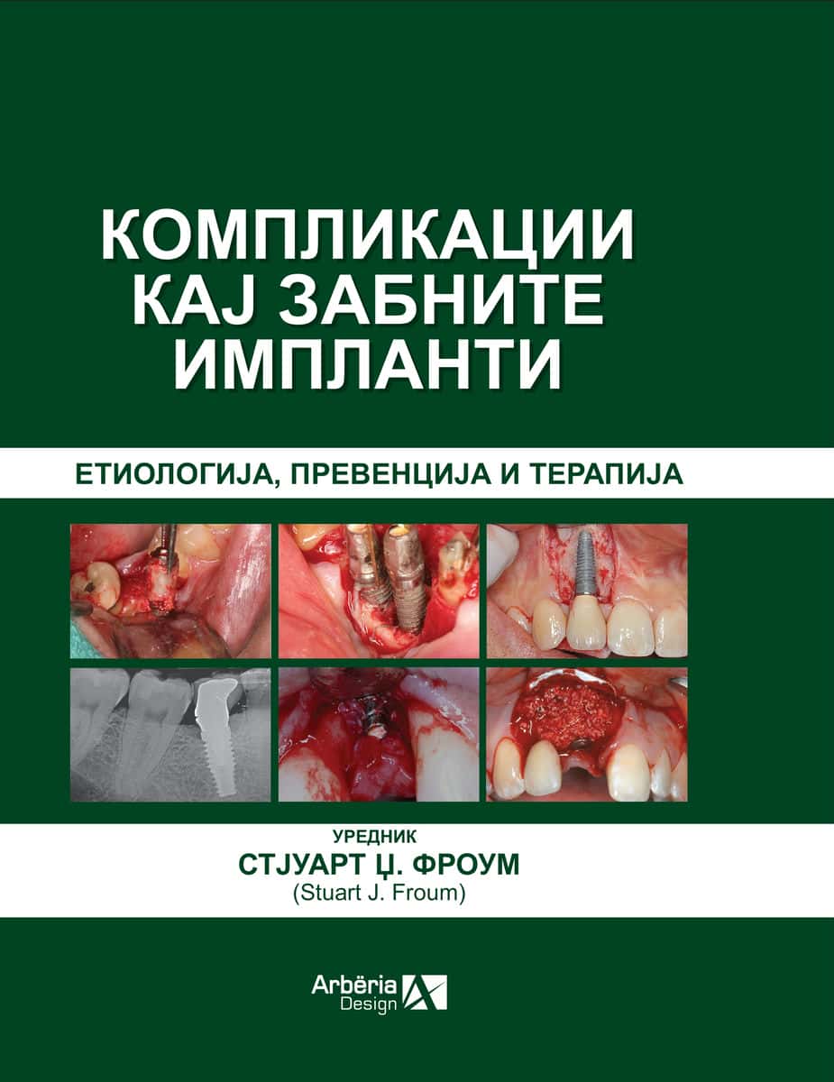 КОМПЛИКАЦИИ КАЈ ЗАБНИТЕ ИМПЛАНТИ